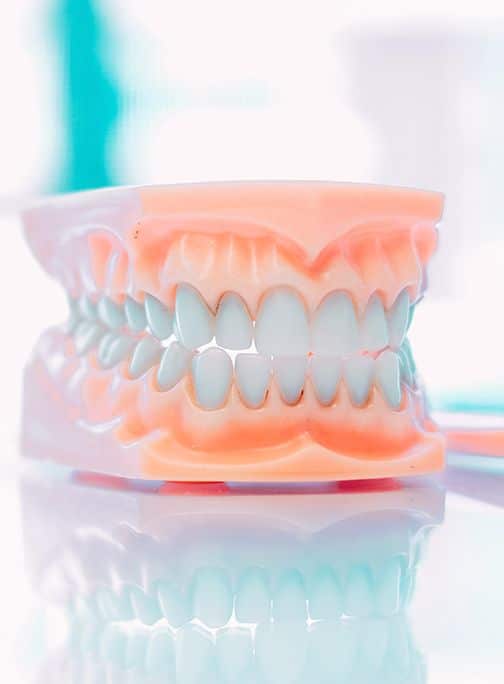 Teeth Whitening - Blanchiment dentaire - Centre Dentaire Ahuntsic